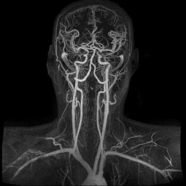 снимок МРТ сосудов шеи и головного мозга